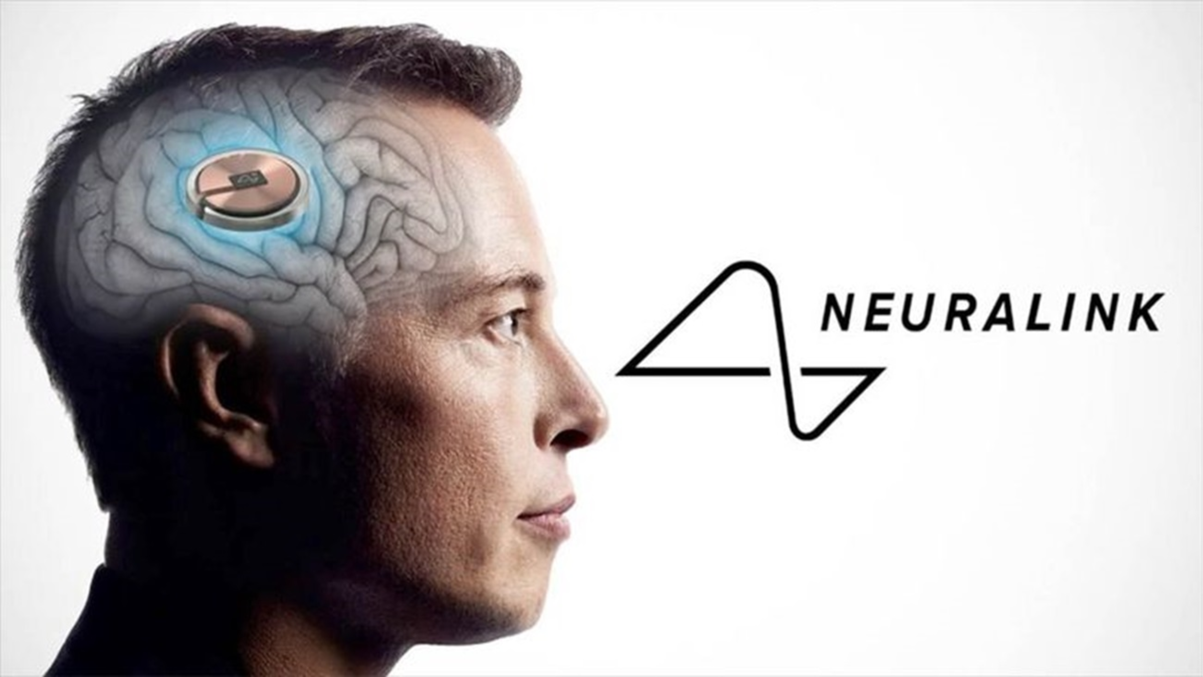 L’implant cérébral Neuralink