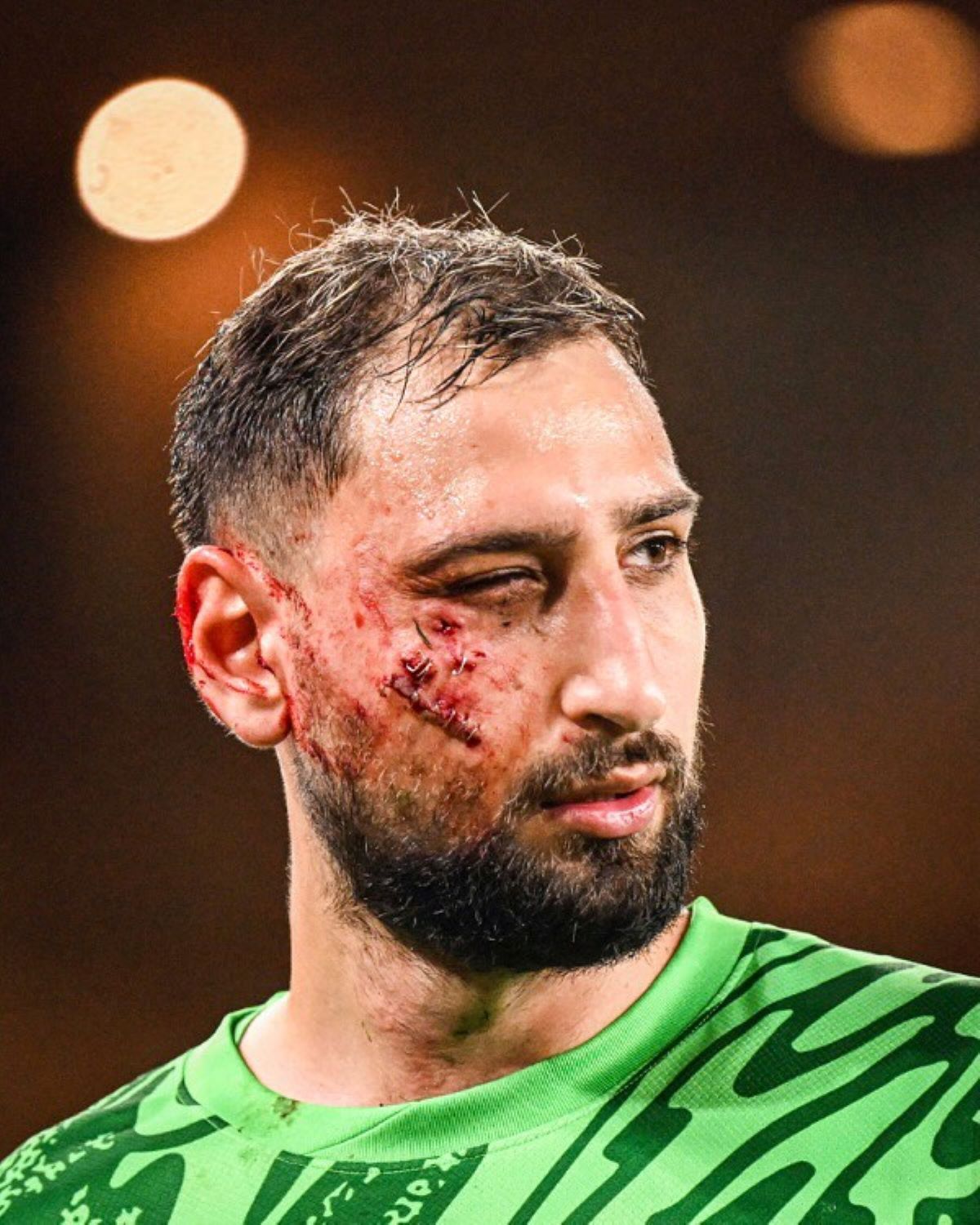 Donnarumma